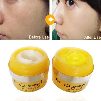 2DB/Készlet Citrom Arcod Éjjel-Nappal arckrém Távolítsa el a Krém a Bőr Szeplő Érdekel, Emelő-Sótalanító Érdekel, Fogfehérítés moisturizin A8Y3 2